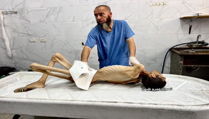 مشهد مروّع.. استشهاد شابين جوعا في غزة