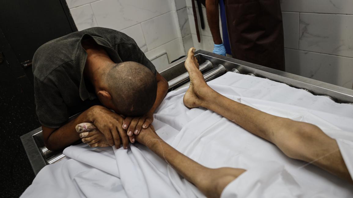 7 ضحايا جدد للتجويع الصهيوني في غزة خلال 24 ساعة