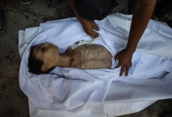 عدد ضحايا التجويع الصهيوني في غزة يرتفع إلى 188 شهيداً