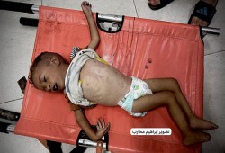 استشهاد 5 فلسطينيين جوعا بغزة