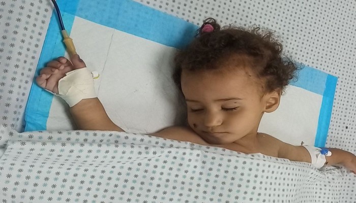 استشهاد طفلة جوعا في بيت حانون شمالي غزة