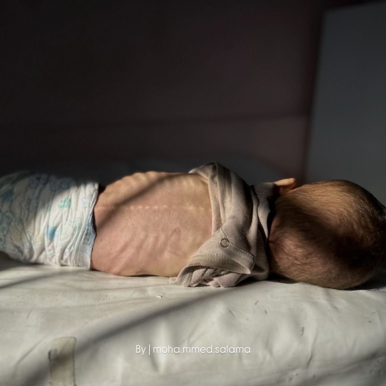 استشهاد 6 فلسطينيين جوعا في غزة بينهم طفلان