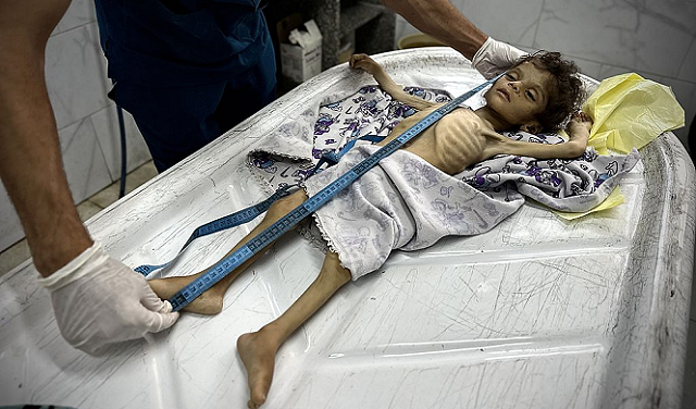 استشهاد 5 فلسطينيين جوعا بغزة