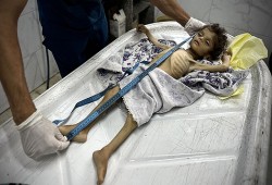 استشهاد 5 فلسطينيين جوعا بغزة