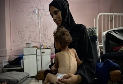 3 شهداء اليوم بسبب التجويع في غزة