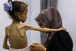 أونروا: يمكن وقف المجاعة في غزة بإدخال المساعدات فورا