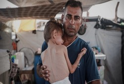 ارتفاع عدد ضحايا التجويع في غزة إلى 303 شهداء بينهم 117 طفلا