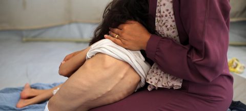 أوتشا: سيناريو التجويع في غزة يزداد بشاعة