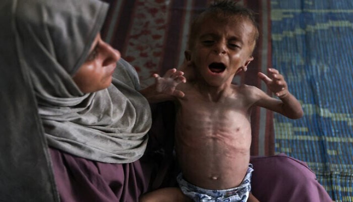 استشهاد 10 فلسطينيين جوعا في غزة بينهم طفلان