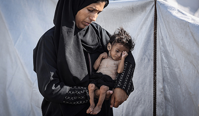 4 شهداء اليوم بسبب التجويع في غزة والعدد يرتفع إلى317