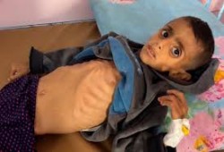 5شهداء جوعا اليوم في غزة والعدد يصل 322