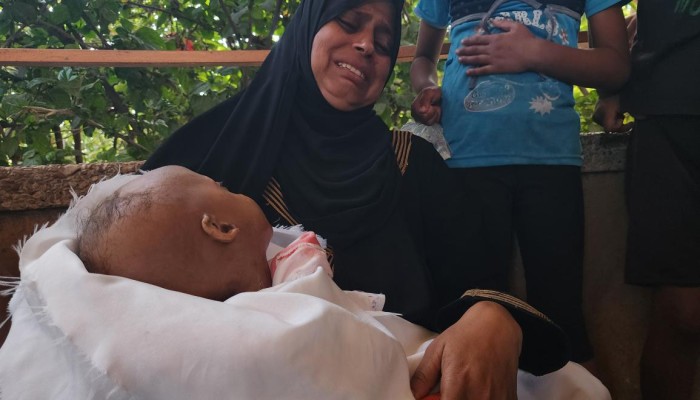 13 شهيداً بسبب التجويع في غزة خلال 24 ساعة