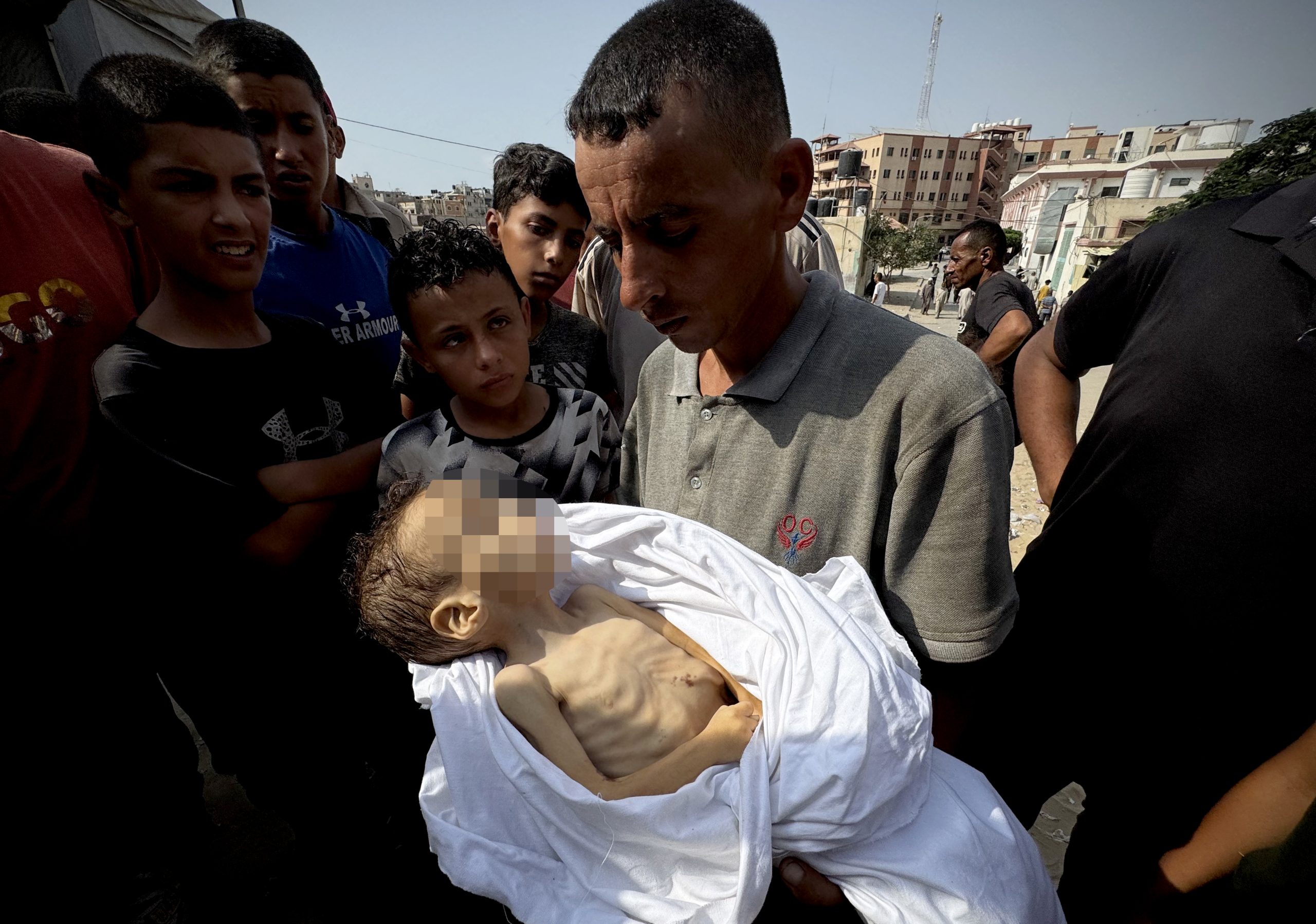 6 شهداء جوعا في غزة والعدد يصل382 ضحية