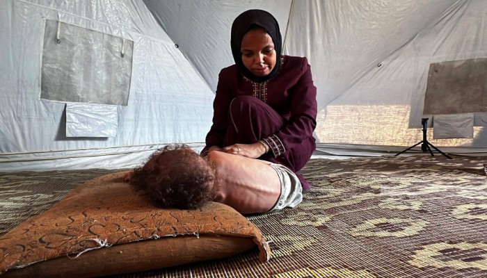 استشهاد طفلة جوعا اليوم في خانيونس بغزة