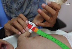 ارتفاع حصيلة ضحايا التجويع بغزة إلى 453 شهيداً