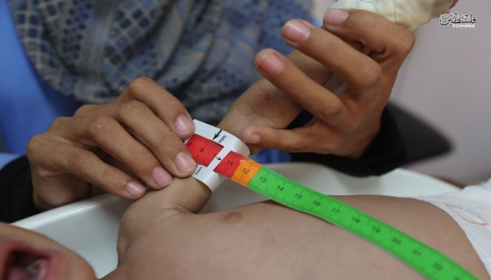 ارتفاع حصيلة ضحايا التجويع بغزة إلى 453 شهيداً