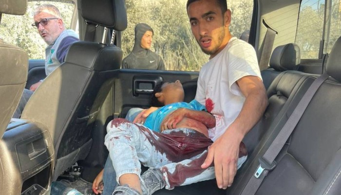 استشهاد طفل فلسطيني برصاص الاحتلال جنوبي الخليل