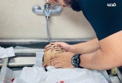 شهيد متأثرًا بإصابته برصاص الاحتلال في مخيم عسكر بنابلس