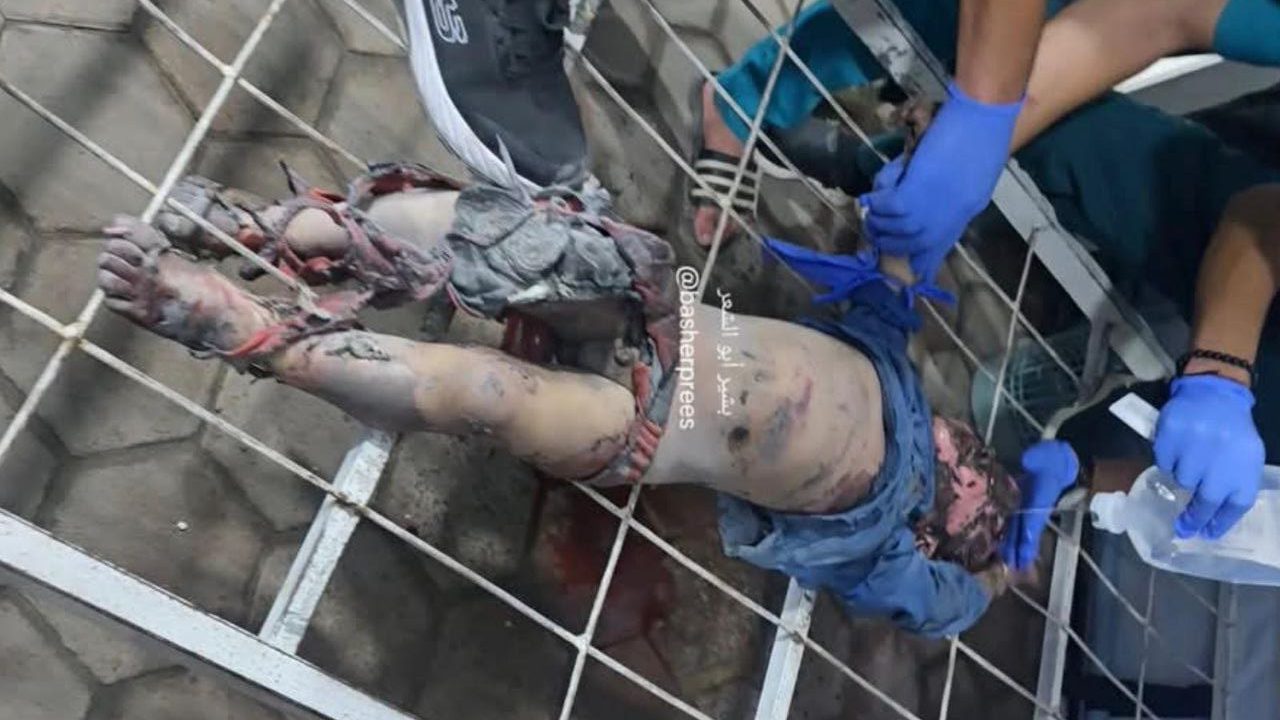 28 شهيدًا و77 مصابًا بنيران الاحتلال في خروقاتٍ متواصلةٍ للتهدئة بغزة