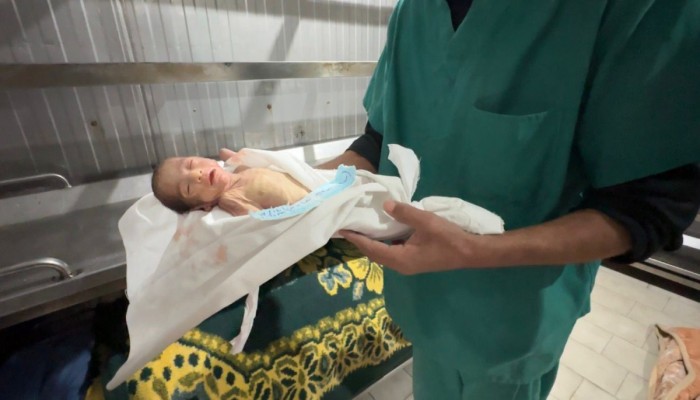 11% انخفاضاً بمعدل المواليد في قطاع غزة