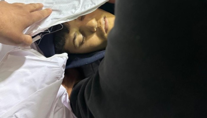 استشهاد طفل فلسطيني في حي الزيتون برصاص الاحتلال