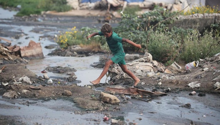 9 آلاف إصابة بأمراض جلدية خلال أسبوعين في غزة