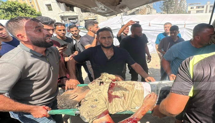 10 شهداء و65 مصابًا في غزة خلال 48 ساعة